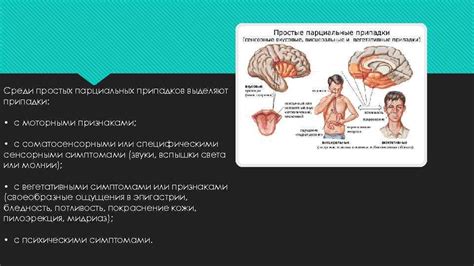  Современные методы лечения парциальных припадков 