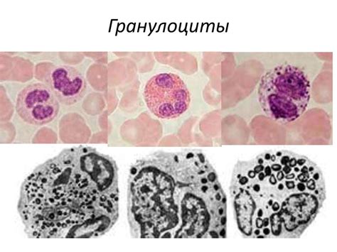  Что такое незрелые гранулоциты и их роль в организме 