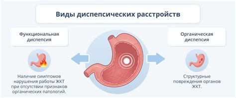  Что такое функциональная диспепсия 