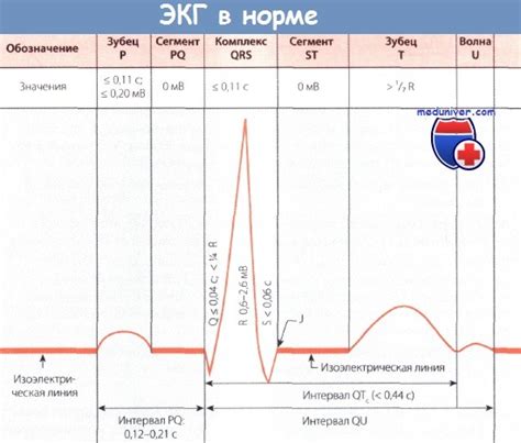 QRS комплекс на ЭКГ: что он значит