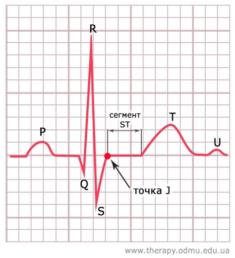 ST-сегмент на ЭКГ: его значение и возможные отклонения