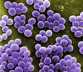 Staphylococcus aureus 10^3: определение и значение